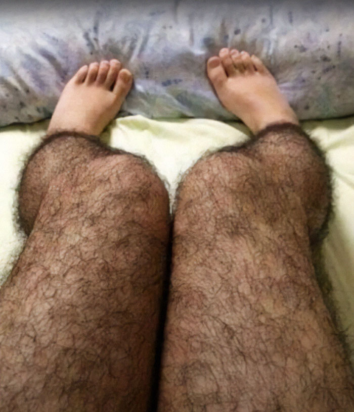 Legs covered with thick, hairy fabric resembling a weird invention from unusual and unexpected designs.