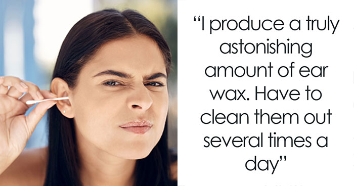 50 Mysterious Body Quirks People Can’t Find Answers For