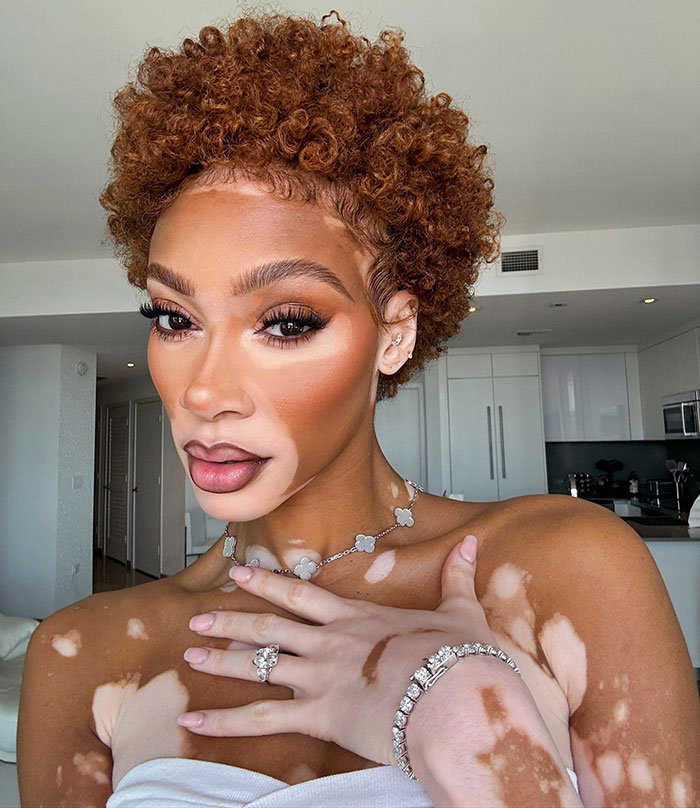 Winnie Harlow posing indoors, showcasing her unique skin and natural beauty as a living piece of artwork. - 1
