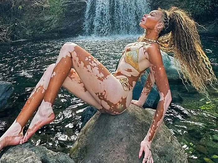 Winnie Harlow poses in a golden bikini by a waterfall, showcasing her unique beauty and stunning skin pattern. - 3