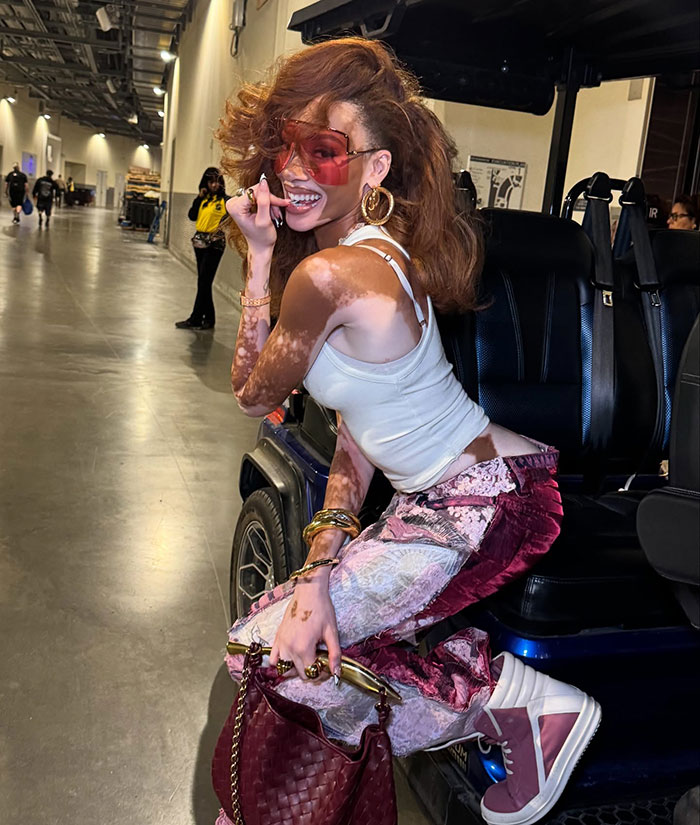 Winnie Harlow smiling, wearing casual outfit and oversized sunglasses, showing her vitiligo skin in a backstage hallway. - 10
