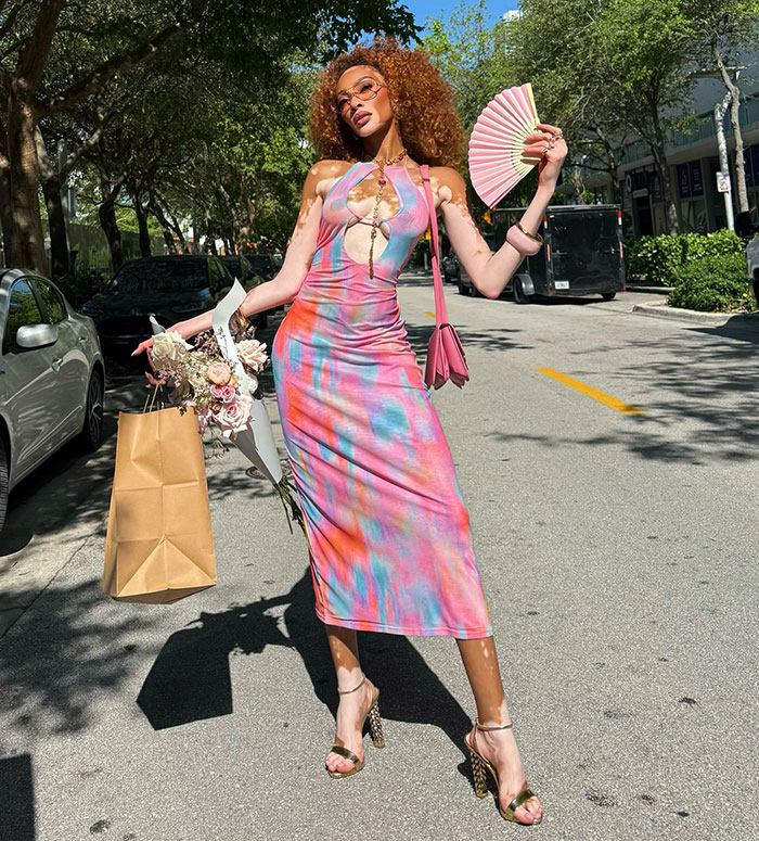 Winnie Harlow poses confidently outdoors in a colorful dress, showcasing her stunning look celebrating her 31st birthday. - 5