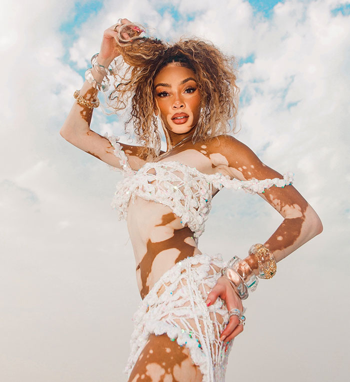 Winnie Harlow posing in a white crochet bikini, showcasing her vitiligo and stunning look under a bright sky. - 12