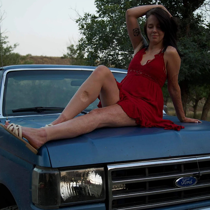 Woman burned in gas station explosion wearing red dress, sitting confidently on a blue vintage Ford truck outdoors. - 9