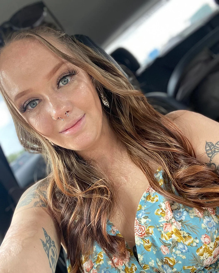 Woman burned in gas station explosion smiling with long hair and floral top showing transformation years later - 10