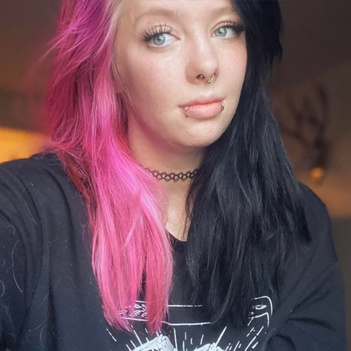 Young woman with pink and black hair, wearing a choker and black shirt, showing transformation after gas station explosion burn. - 6