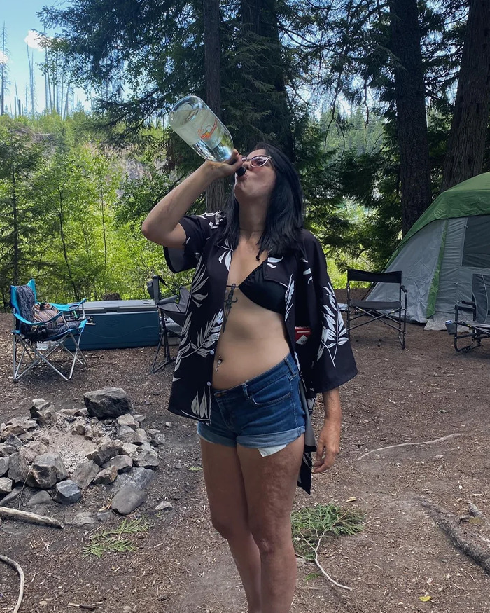 Woman burned in gas station explosion outdoors, wearing sunglasses and shorts, drinking from a bottle in a forest campsite. - 8