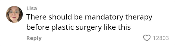 Comment from Lisa advocating mandatory therapy before plastic surgery in a discussion about women who get facelifts at 28. Comment from Lisa advocating mandatory therapy before plastic surgery in a discussion about women who get facelifts at 28.