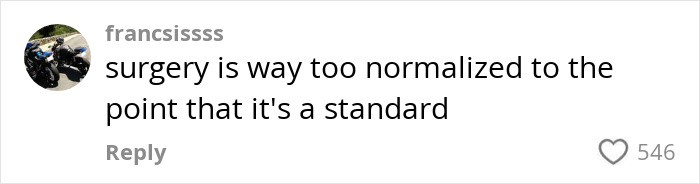 Social media comment highlighting how facelifts and surgery are normalized among young women at 28, sparking discussion on harm. Social media comment highlighting how facelifts and surgery are normalized among young women at 28, sparking discussion on harm.