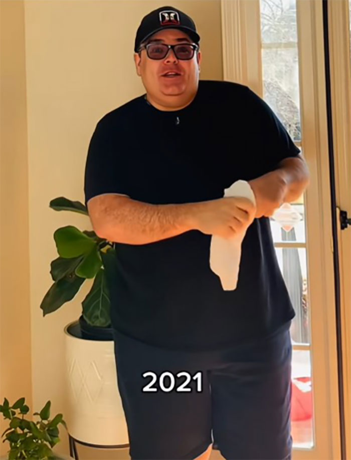 Man in casual clothes inside home before facelift, showcasing transformation with main SEO keywords facelift Mexico reveal. Man in casual clothes inside home before facelift, showcasing transformation with main SEO keywords facelift Mexico reveal.