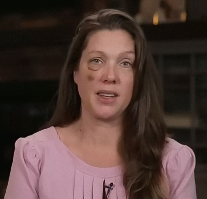 Single mom with a bruised face speaking out after brutal beating by Cincinnati mob, addressing police chief’s statement. Single mom with a bruised face speaking out after brutal beating by Cincinnati mob, addressing police chief’s statement.