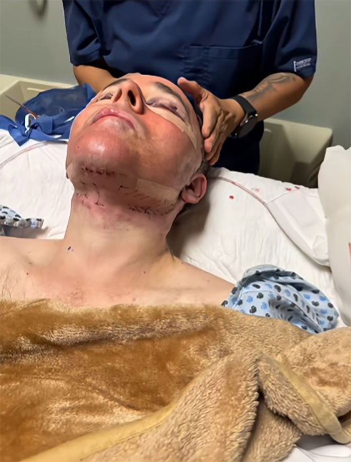 Man recovering on hospital bed after a facelift procedure in Mexico with visible facial sutures and medical staff attending. Man recovering on hospital bed after a facelift procedure in Mexico with visible facial sutures and medical staff attending.