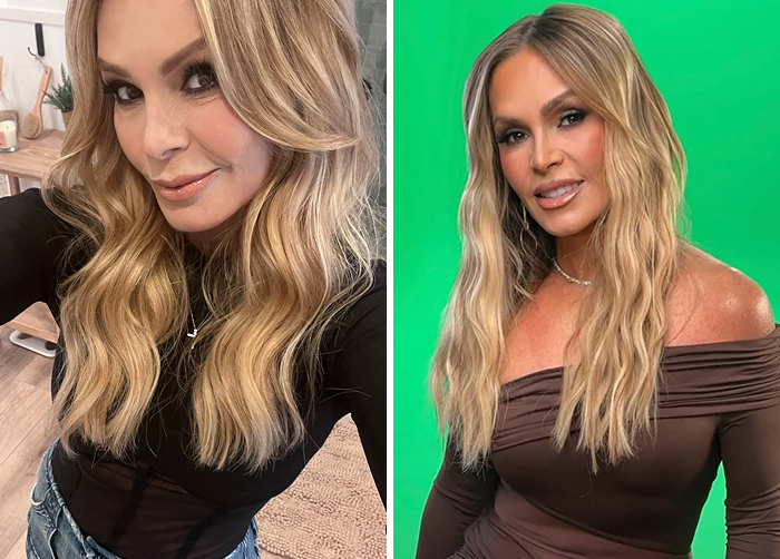 Side-by-side before and after photos of a Tamra Judge showing results of replacing regular Botox with lip flip treatment.