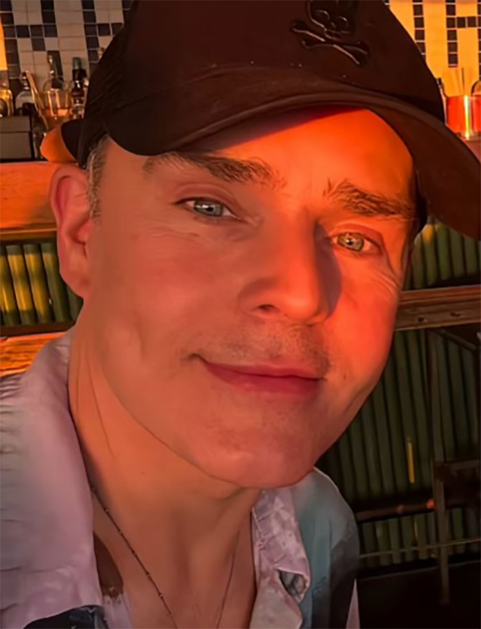 Close-up of a man after a facelift in Mexico, showcasing his refreshed appearance in warm lighting. Close-up of a man after a facelift in Mexico, showcasing his refreshed appearance in warm lighting.