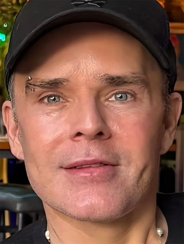 Close-up of a man with clear skin and blue eyes after a facelift in Mexico, wearing a black cap indoors. Close-up of a man with clear skin and blue eyes after a facelift in Mexico, wearing a black cap indoors.