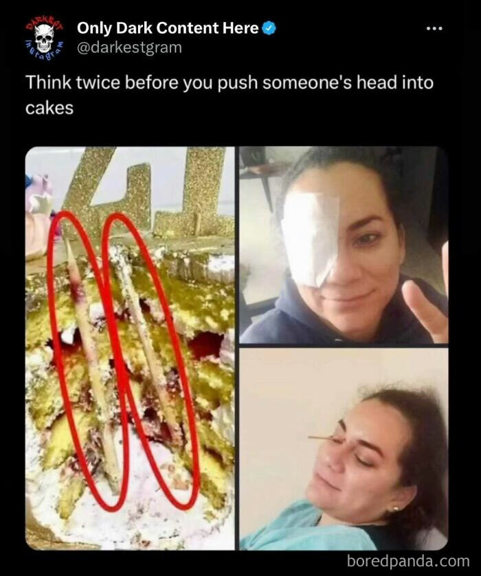 Injuries from a creepy Instagram post showing a disturbing cake incident and a person with eye bandages.