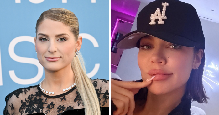 15 Before-And-After Photos Of Celebs Who Replaced Regular Botox With “Lip Flip” For A New Kind Of Look