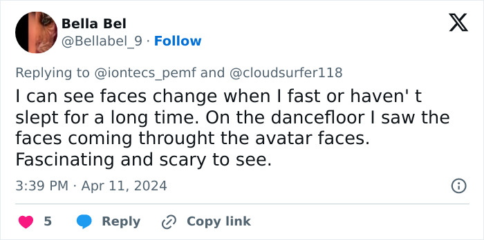 Tweet screenshot showing a woman describing a rare condition where she sees faces change and dragons instead of people.