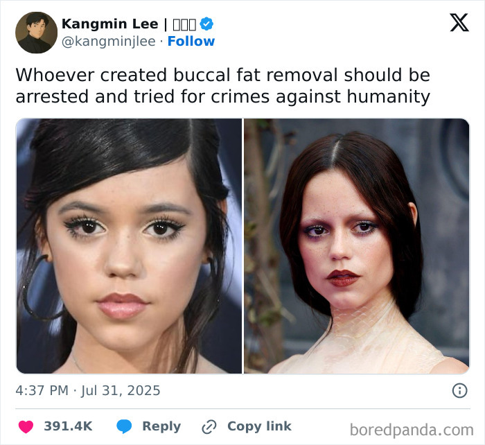 Tweet humor about buccal fat removal featuring side-by-side portraits, capturing the chaos and laughter of random memes.