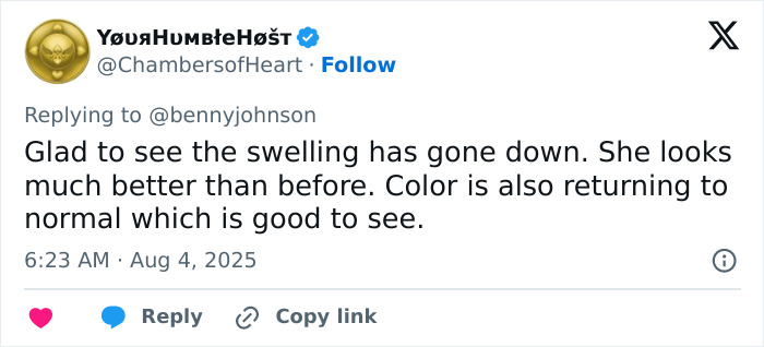 Tweet showing support for mom brutally punched and knocked out during violent Cincinnati brawl, mentioning swelling going down.