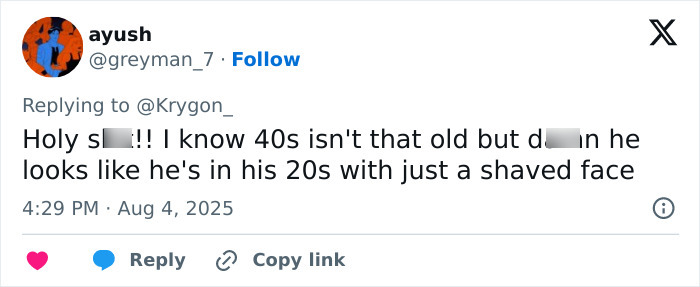 Screenshot of a tweet discussing Andrew Garfield&rsquo;s latest look and the major Botox buzz it has sparked.