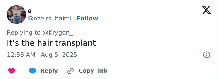 Andrew Garfield in a close-up photo highlighting his latest look, fueling major botox buzz and vampire advantages.