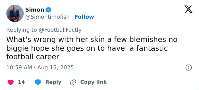 Tweet defending new soccer team signing&rsquo;s appearance amid online troll backlash on skin blemishes and support for her career.