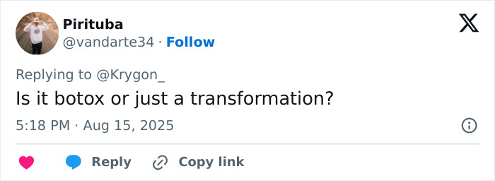 Andrew Garfield&rsquo;s latest look causing major botox buzz, highlighting the advantages of being a vampire transformation.