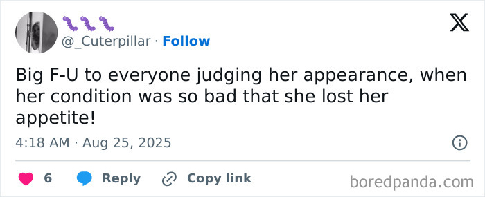 Tweet criticizing judgment of Britney Spears' appearance after sparking worry and mentioning need for mental help.