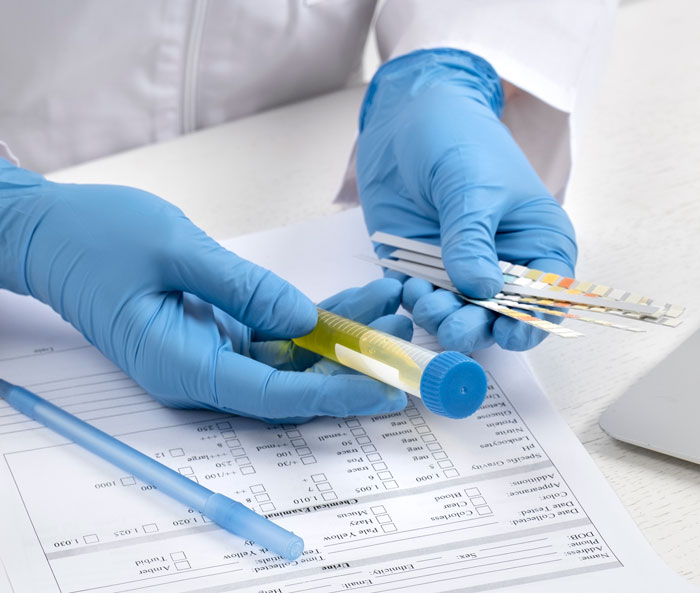 Person in blue gloves handling urine sample and test strips, illustrating DNA test mixed result analysis.