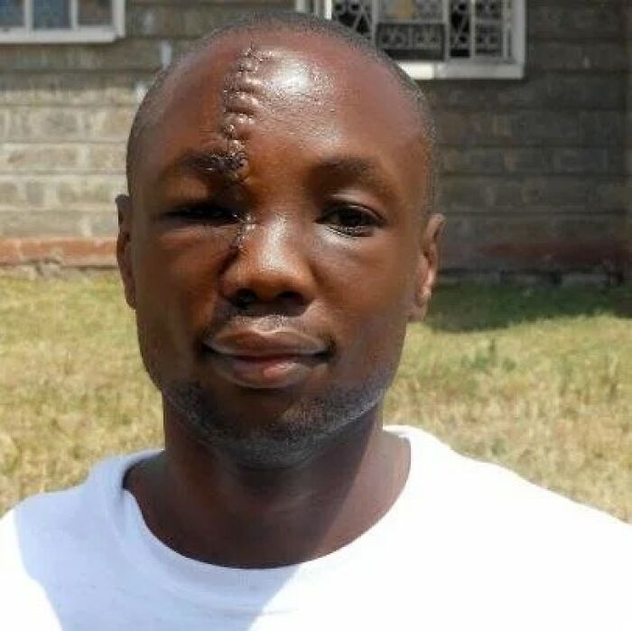 Close-up of a man with a large scar running from forehead to cheek, an unsettling image from the Morbid Knowledge group.