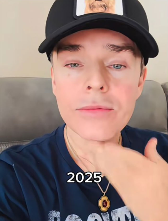 Man showing results of Mexico facelift procedure with a smooth, youthful face and clear skin in casual wear. Man showing results of Mexico facelift procedure with a smooth, youthful face and clear skin in casual wear.