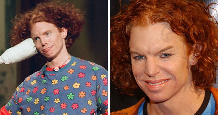 20 Before-And-After Pictures Of Celebs Who Went Too Far With Plastic Surgery