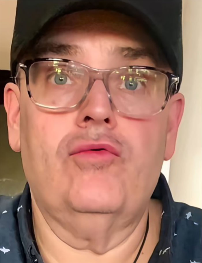 Man wearing glasses and cap sharing his story after a facelift in Mexico with a surprised expression. Man wearing glasses and cap sharing his story after a facelift in Mexico with a surprised expression.