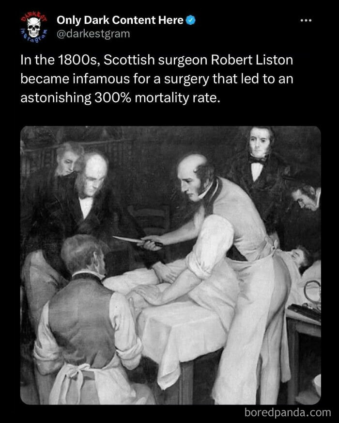 Black and white historic image of 1800s surgery with multiple men, highlighting darkest page on Instagram creepy stories.