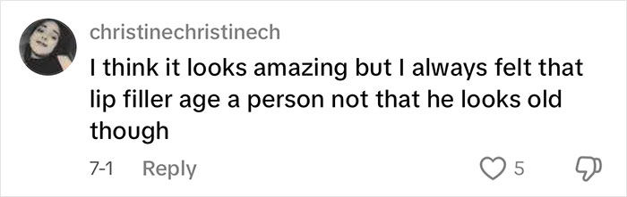 Person sharing opinion in a comment about lip filler age effect, related to facelift trips to Mexico discussion. Person sharing opinion in a comment about lip filler age effect, related to facelift trips to Mexico discussion.