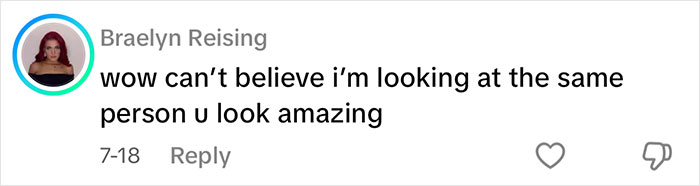 Comment praising a man's facelift in Mexico, amazed at the transformation and how amazing he looks after the big reveal. Comment praising a man's facelift in Mexico, amazed at the transformation and how amazing he looks after the big reveal.