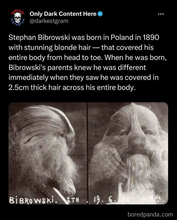 Vintage black and white photos of Stephan Bibrowski with hair covering his entire body on darkest Instagram page.