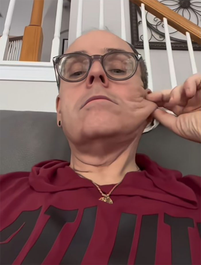 Man wearing glasses pulls skin on his face showing results of facelift procedure in Mexico in a casual home setting. Man wearing glasses pulls skin on his face showing results of facelift procedure in Mexico in a casual home setting.