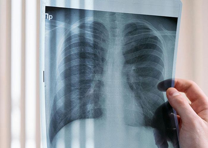 Person holding a chest x-ray image, related to jobs that only a person without a soul would do.