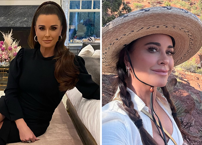 Before and after photos of a Kyle Richards showing a new look with lip flip treatment instead of regular Botox.