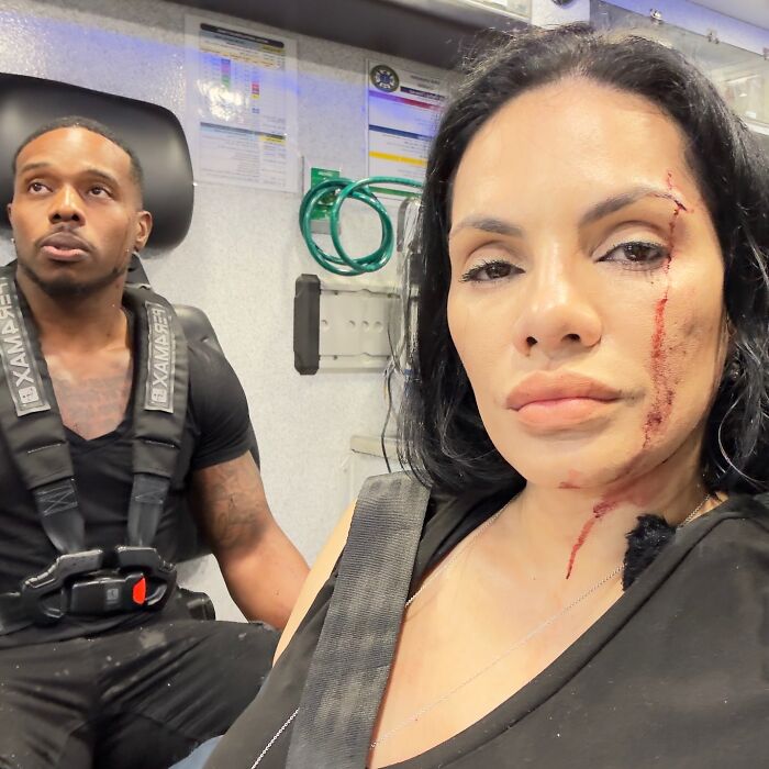 Injured couple inside ambulance after SUV accident, showing bleeding and seatbelts, related to terrifying SUV crash footage.