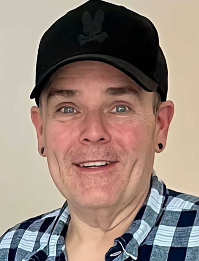 Man wearing black cap and plaid shirt smiling after a facelift in Mexico, showing his big reveal and youthful look. Man wearing black cap and plaid shirt smiling after a facelift in Mexico, showing his big reveal and youthful look.