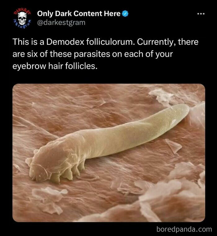 Microscopic image of a Demodex folliculorum parasite on skin, featured on Darkest Page Instagram dark creepy stories.