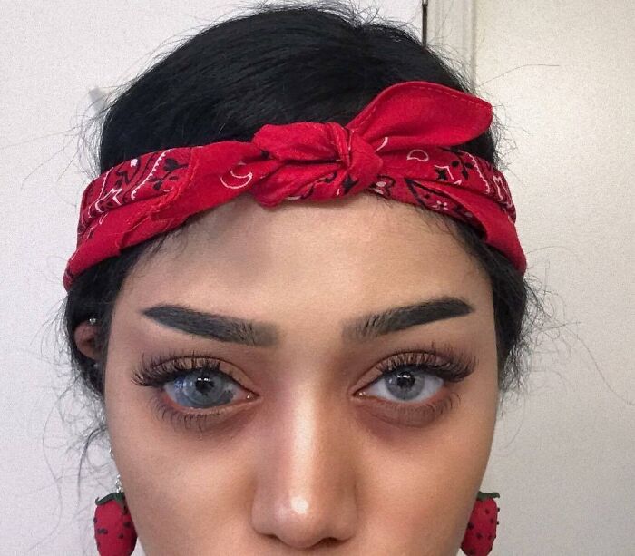 Close-up of a woman with a unique birth mark covering one eye, wearing a red headband and strawberry earrings.