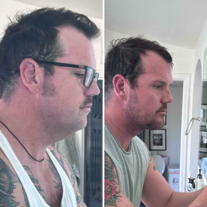 Before and after plastic surgery transformation showing a man’s side profile with visible tattoo sleeves indoors.