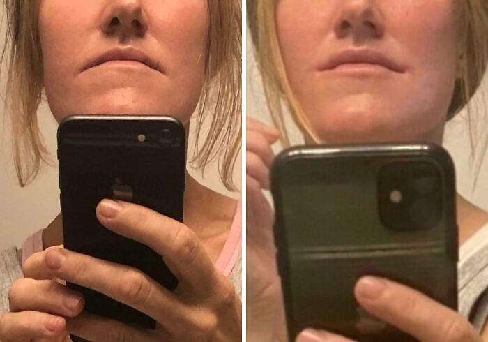 Side-by-side before and after plastic surgery selfies showing facial transformation of a woman from everyday to polished look.