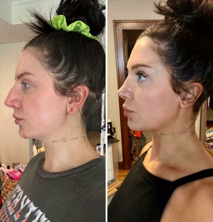 Side-by-side before and after plastic surgery photos showing transformation from mom at Costco to Beverly Hills housewife look.