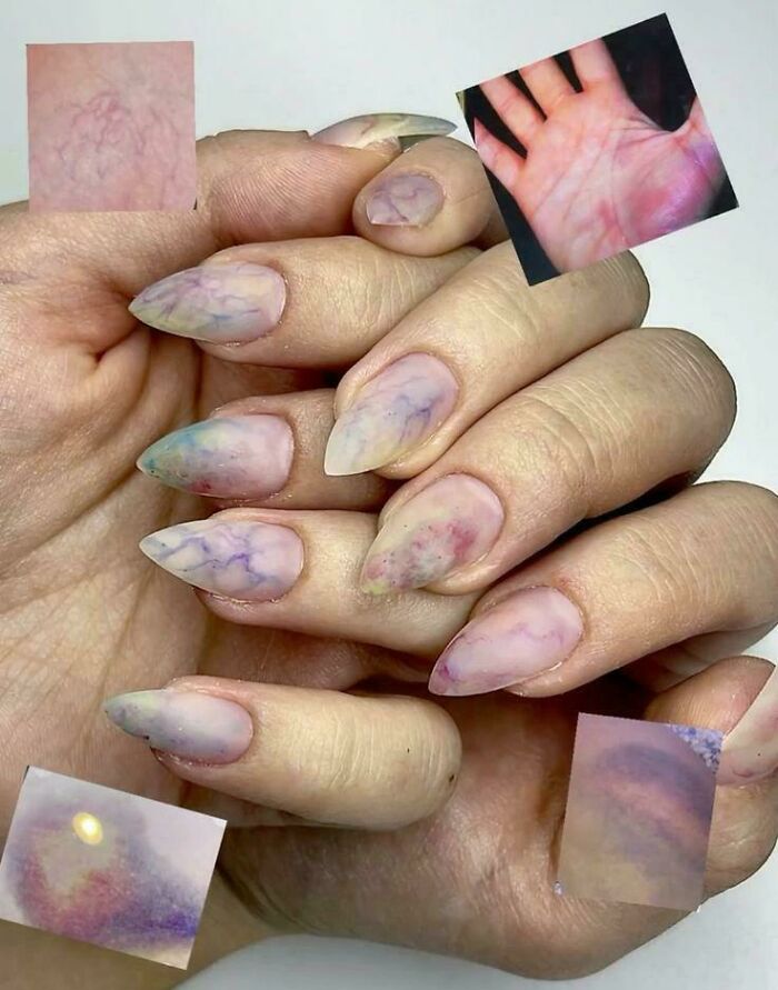Nail art with vein-like designs resembling skin with visible veins, an example of awful taste but great e*******n.