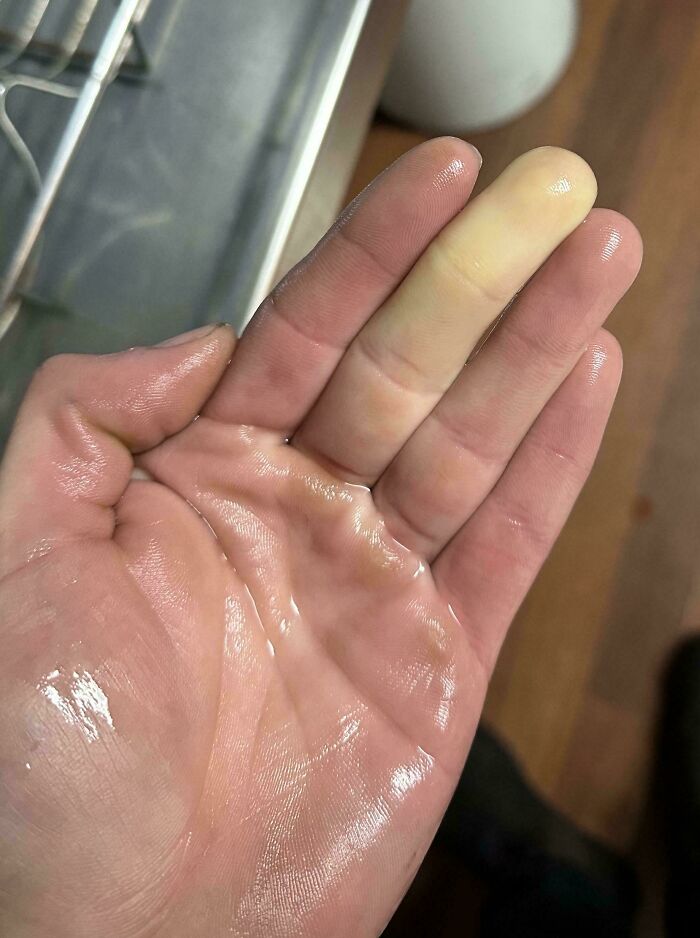 Close-up of a wet hand with a moderately interesting yellowish middle finger, shared as a new moderately interesting pic.